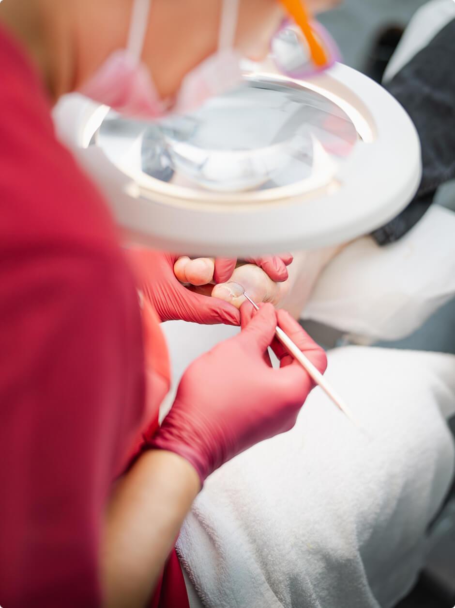 Was ist eine Nagelprothetik?