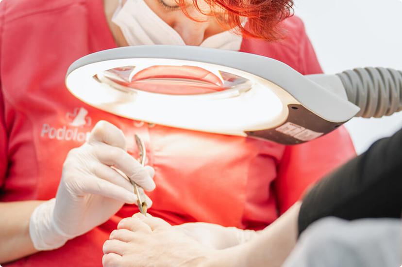 Hühneraugen & Warzen