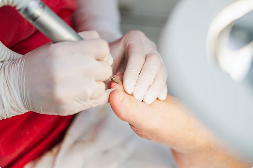 Podologische Komplexbehandlung